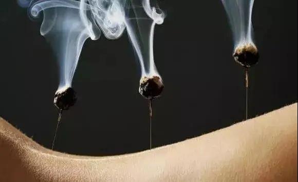 艾灸不是藥，調(diào)的不是病，央視為艾灸正名，讓我們正視艾灸