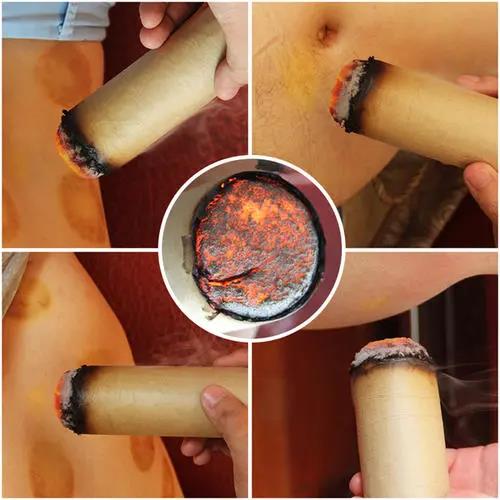 灸溫，到底是燙的好還是溫的好？為什么有的人感覺不到熱?