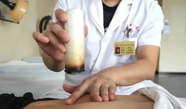產(chǎn)后艾灸一個月，十年少生?。?
