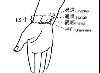 睡覺(jué)愛(ài)出汗，艾灸這幾個(gè)穴位