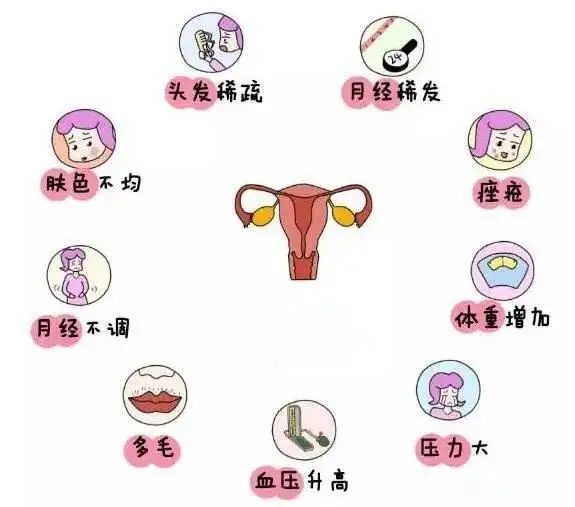 10個女人就有1個患多囊！被它纏上不要怕，艾灸幫你調(diào)“多囊”！